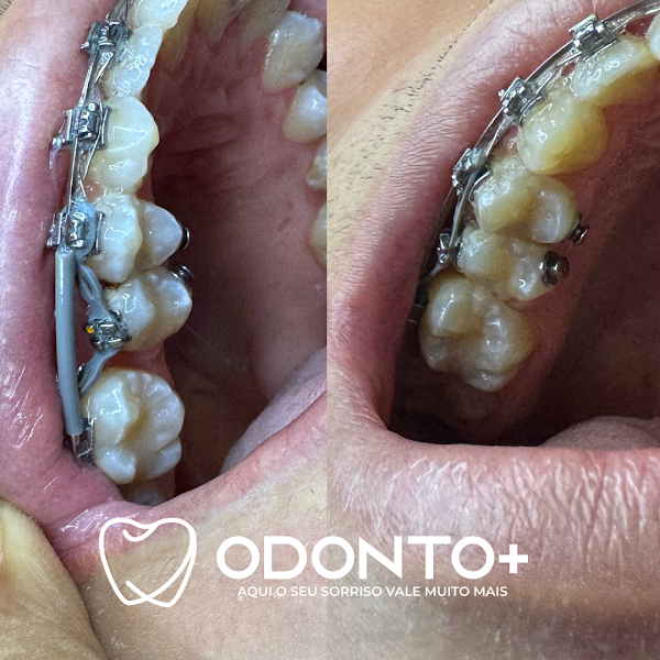 Foto 3 de Odonto+ Candeias | Consultório Odontológico