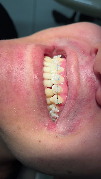 Foto 4 de Odonto+ Candeias | Consultório Odontológico