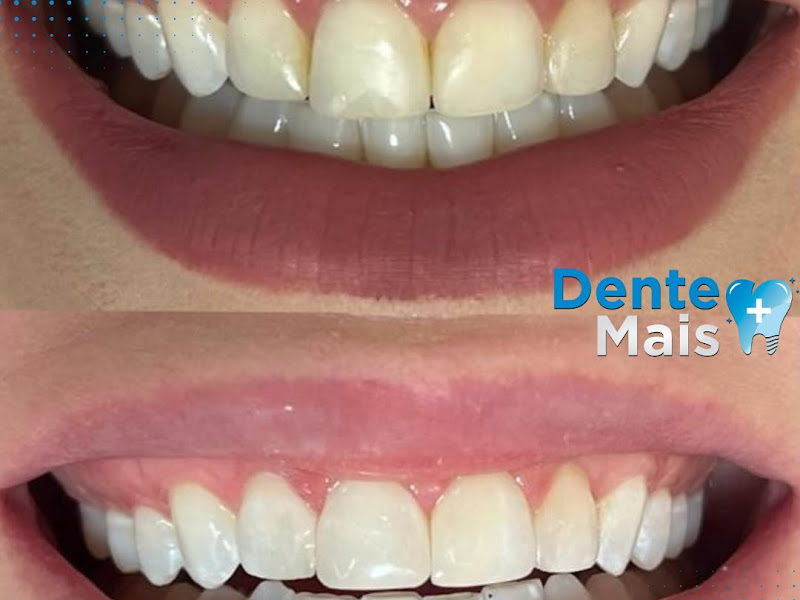 Foto 6 de Odonto Center Palmas