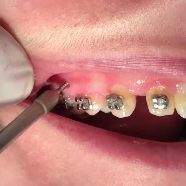 Foto 4 de Odonto Center RS