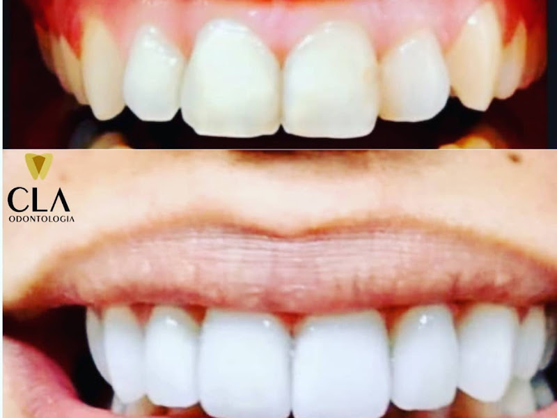 Foto 2 de Odonto Class Clínica Odontológica