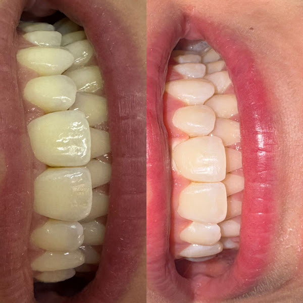 Foto 3 de Odonto Clean