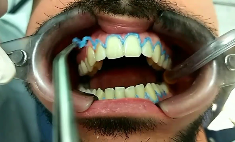 Foto 4 de Odonto Clínica Alecrim Dra. Andrea Régia