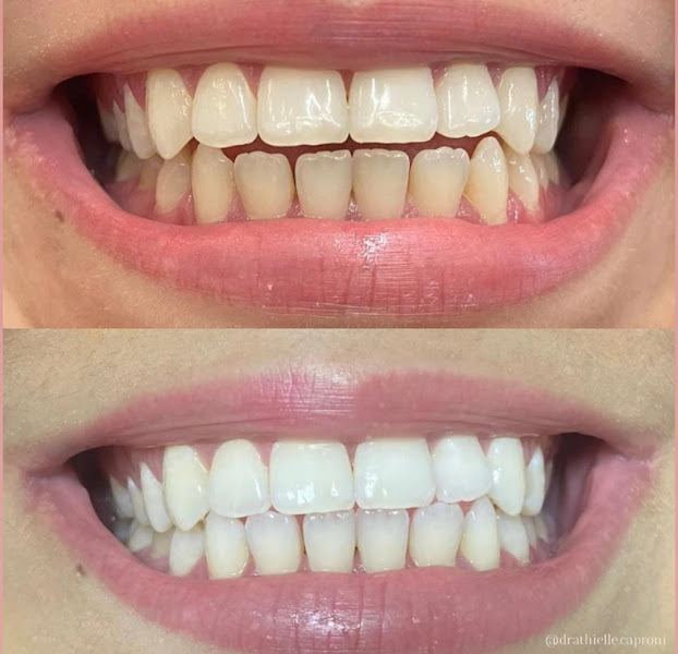 Foto 2 de Odonto Estética BH