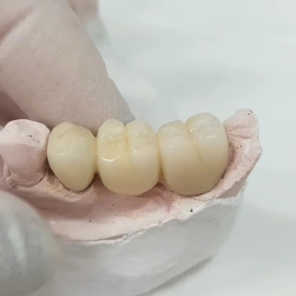 Foto 3 de Odonto Estética e Prótese - Próteses, Implantes e Facetas em Porto Velho