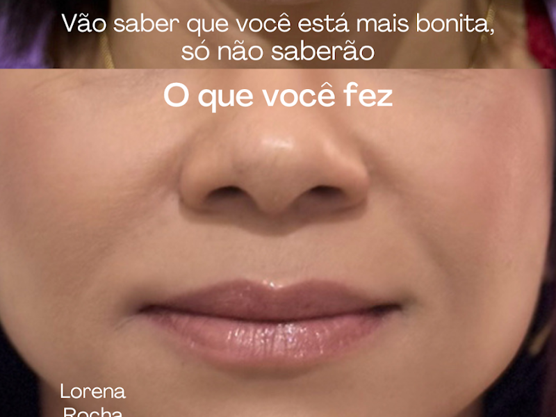 Foto 3 de Odonto Estética