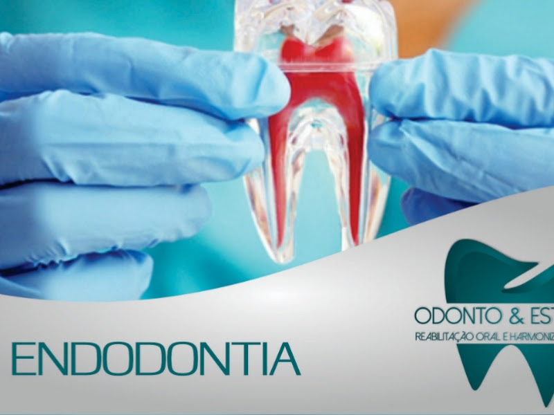 Foto 2 de ODONTO & ESTÉTICA - Reabilitação Oral e Harmonização Facial