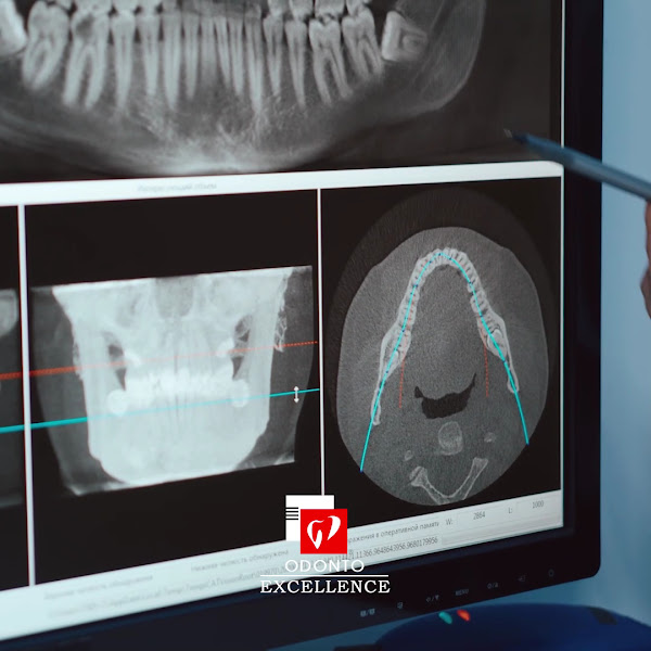 Foto 3 de Odonto Excellence