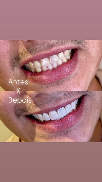 Foto 3 de Odonto Excellence Aparecida de Goiânia