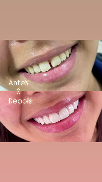 Foto 4 de Odonto Excellence Aparecida de Goiânia