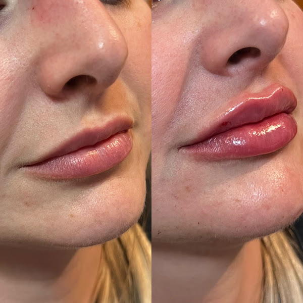 Foto 4 de Odonto Excellence - Clínica Odontológica