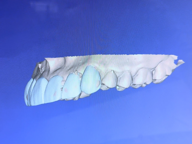 Foto 3 de Odonto Excellence Jardim Alvorada - Maringá/PR