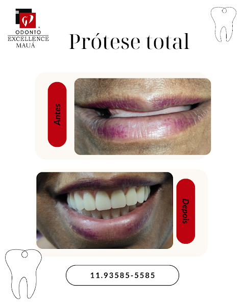 Foto 3 de Odonto Excellence Mauá