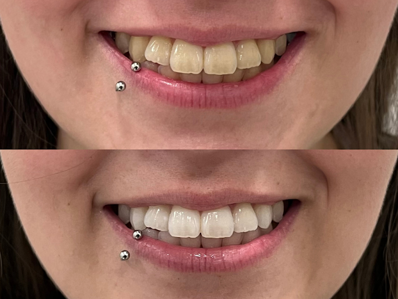 Foto 3 de Odonto Excellence São Roque