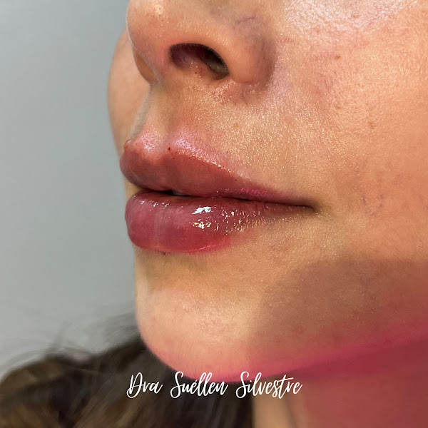 Foto 2 de Odonto Face Clio Instituto de odontologia