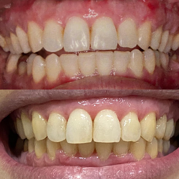 Foto 3 de Odonto Face Clio Instituto de odontologia