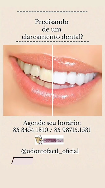 Foto 3 de Odonto Fácil