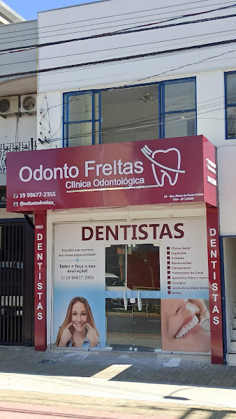 Foto 2 de Odonto Freitas - Clínica Odontológica - Unidade Morada do Sol - Indaiatuba