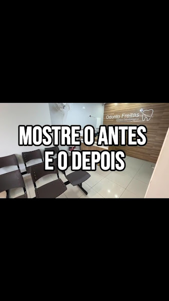 Foto 3 de Odonto Freitas - Clínica Odontológica - Unidade Morada do Sol - Indaiatuba
