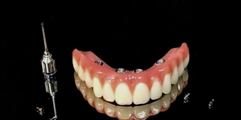 Foto 3 de Odonto Gran Viana