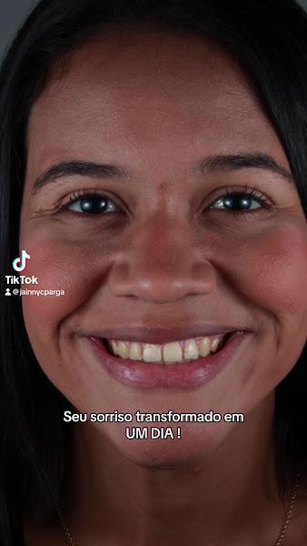 Foto 3 de ODONTO HARMONIE: Odontologia e Harmonização Facial - DENTISTAS