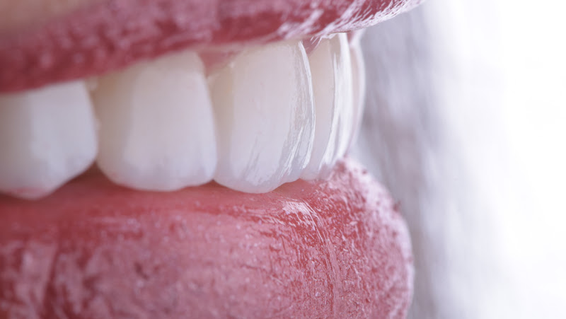 Foto 2 de Odonto Harmony Eusébio