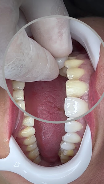 Foto 3 de Odonto Harmony Eusébio