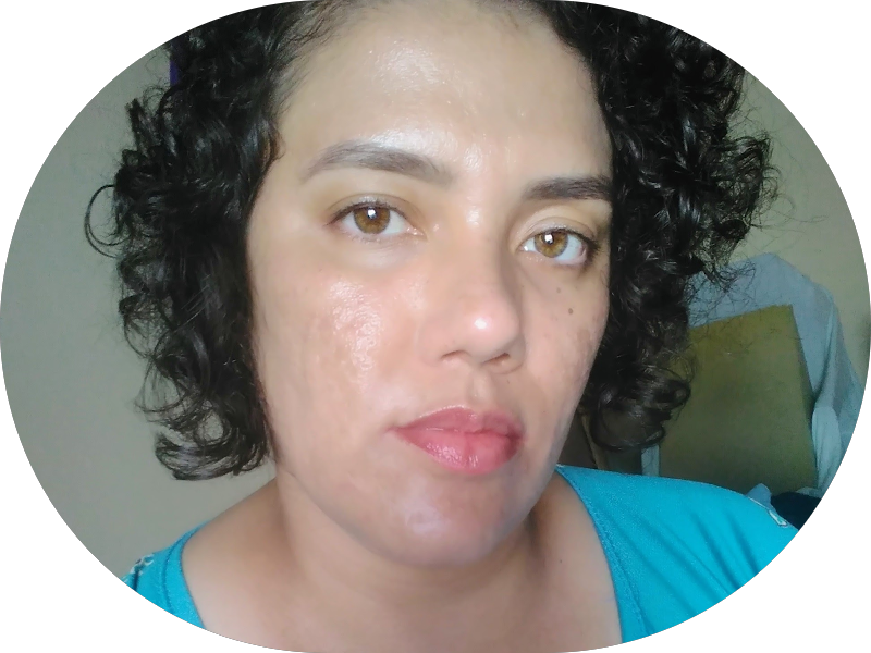 Foto 5 de Odonto Harmony Eusébio