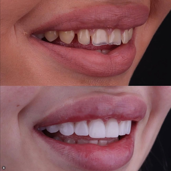 Foto 3 de Odonto Implantes Especialidade / Clínica Dr.Mário Freire Shopping Guararapes