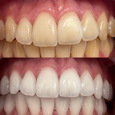 Foto 2 de Odonto Implementar - Centro