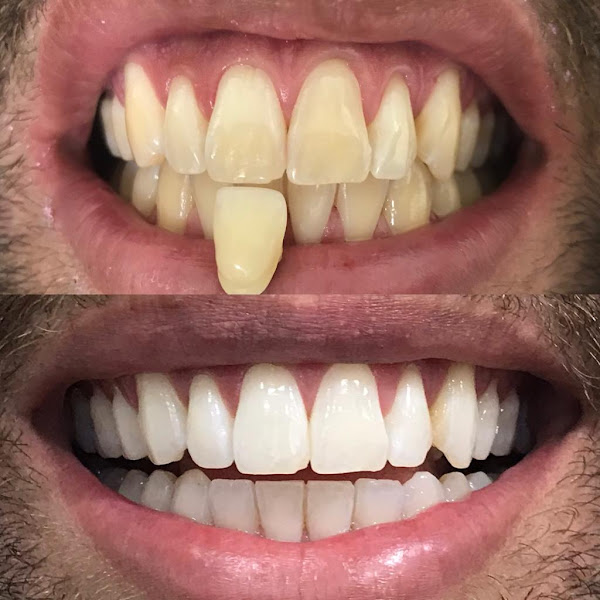 Foto 3 de Odonto Índico