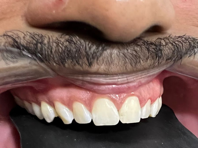 Foto 6 de ODONTO JG - Odontologia integrada e estética - Dra. Joice Emanuele