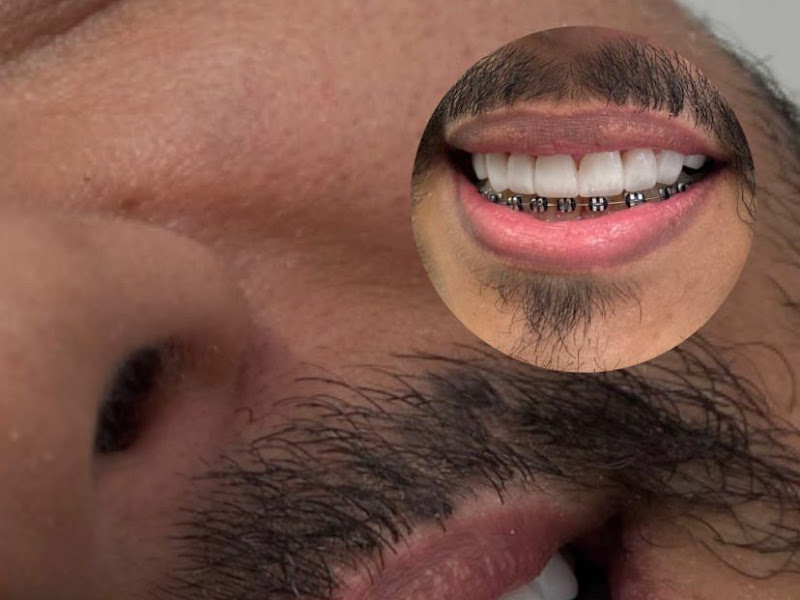 Foto 7 de ODONTO JG - Odontologia integrada e estética - Dra. Joice Emanuele