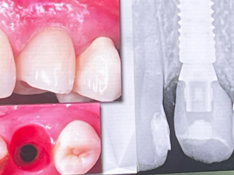 Foto 13 de Odonto João Pessoa – Dentista e Clínico Geral