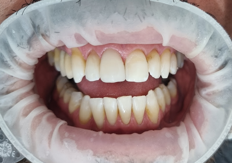 Foto 2 de Odonto Lemes