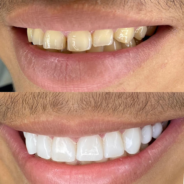 Foto 3 de ODONTO LIDER - DENTISTA EM PETROLINA-PE