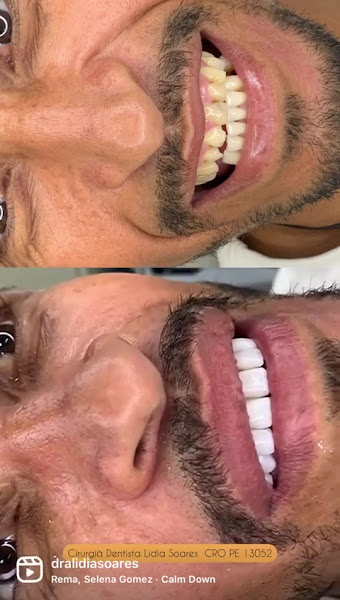 Foto 4 de ODONTO LIDER - DENTISTA EM PETROLINA-PE