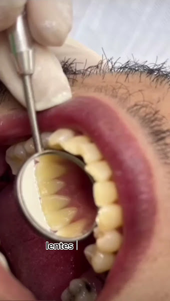 Foto 3 de Odonto Lima Dra. Taylane L Lima