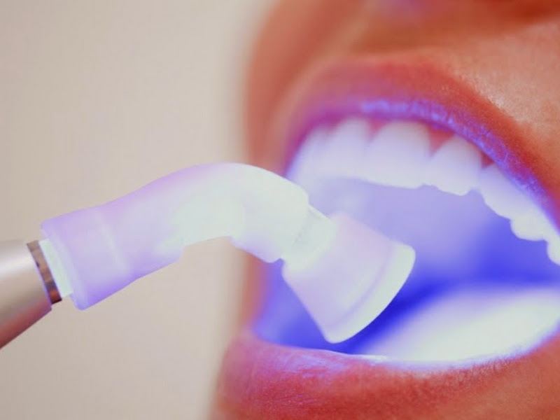 Foto 6 de Odonto Line