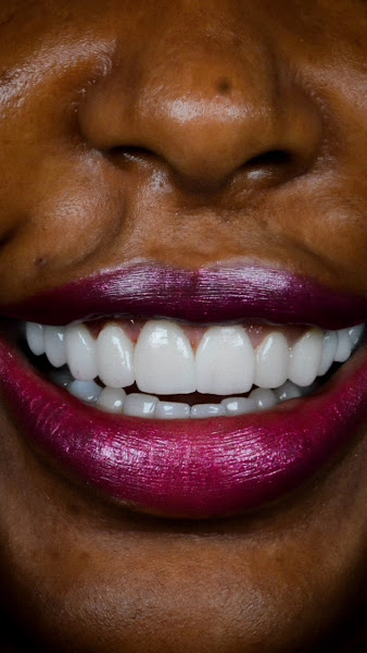 Foto 4 de Odonto Liuzzi | Lentes de Contato Dental | Prótese Protocolo | Ortodontia | Periodontia | Implante Dentário | Dental Tourism