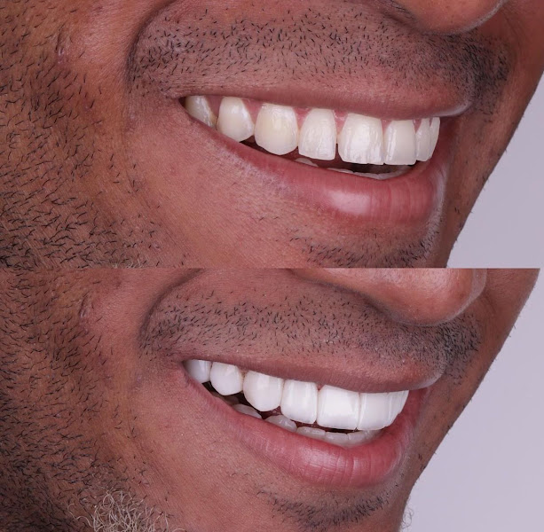 Foto 2 de Odonto Marco - Clinica Odontológica, Dentista e Consultório Odontologico