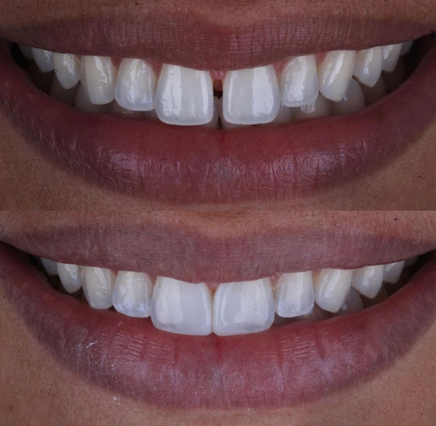 Foto 3 de Odonto Marco - Clinica Odontológica, Dentista e Consultório Odontologico