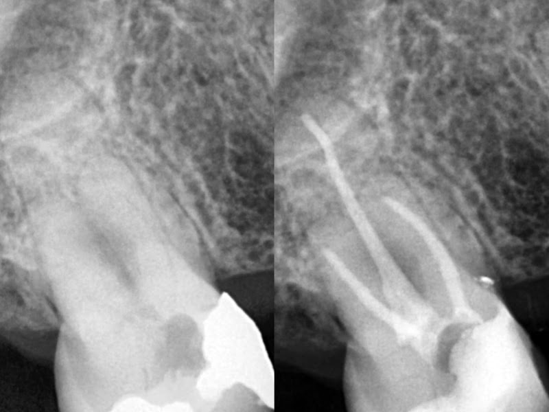 Foto 3 de Odonto Maringá - Dentista Zona 07