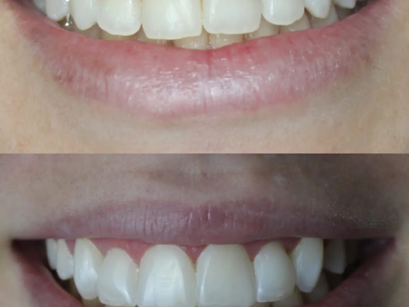 Foto 4 de Odonto Maringá - Dentista Zona 07