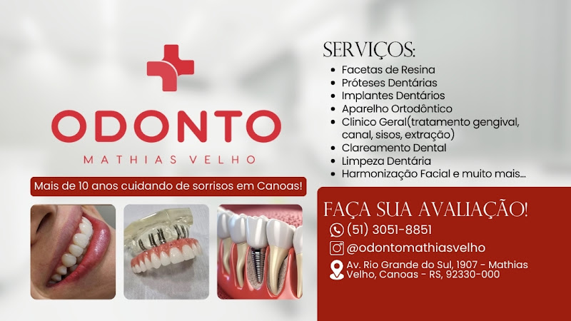 Foto 2 de Odonto Mathias Velho - Próteses e Implantes Canoas