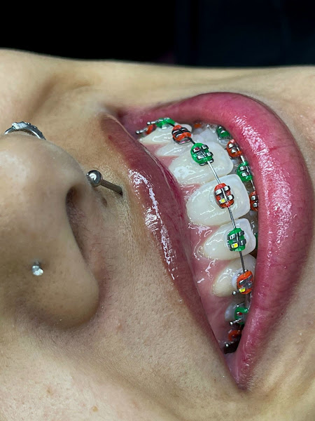 Foto 3 de Odonto Mazzo