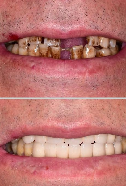 Foto 3 de Odonto Morais