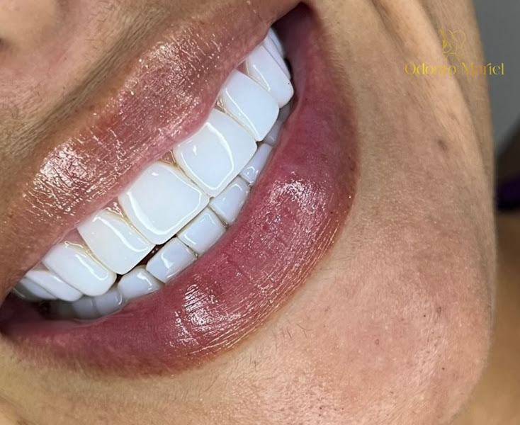 Foto 2 de Odonto Muriel