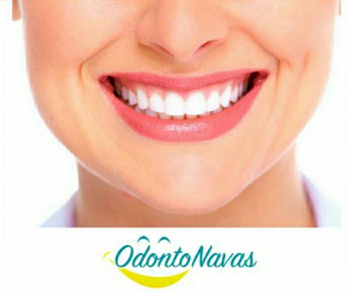 Foto 3 de Odonto Navas - Dentista, Implante e Ortodontia