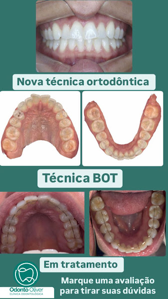 Foto 2 de Odonto Oliver